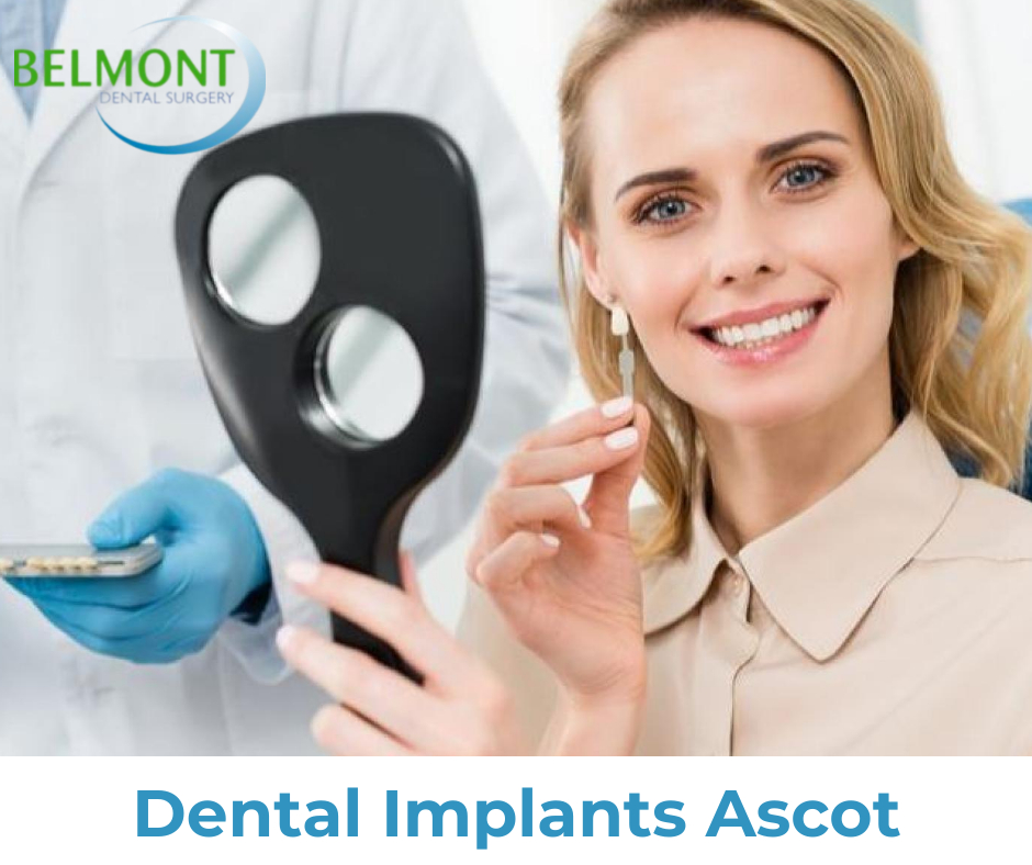 Affordabel Dental Implants Ascot