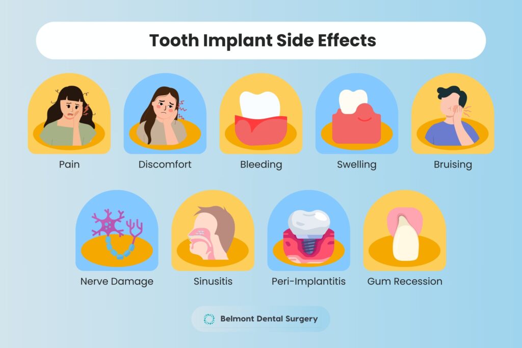 Tooth Implant Side Effects - Complications and Risks
